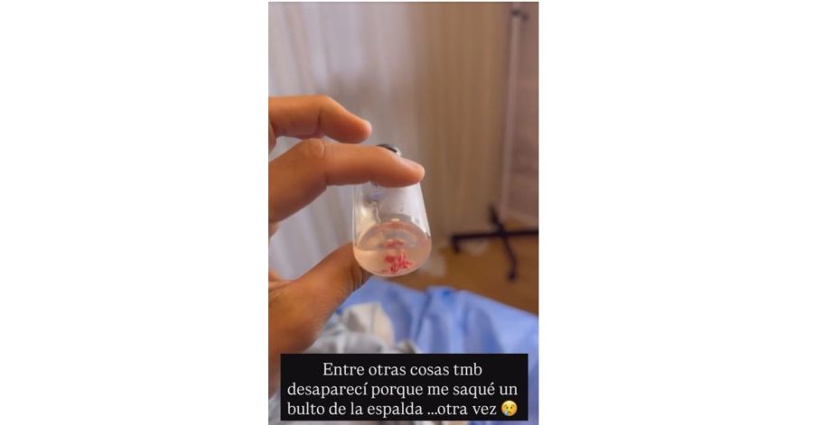 Cinthia Fernández se sometió a una cirugía