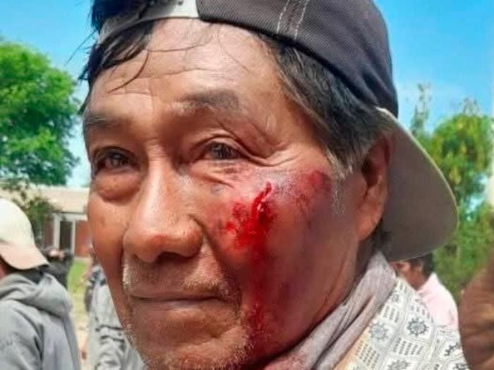 Violecia Policial en Bermejito 16102025