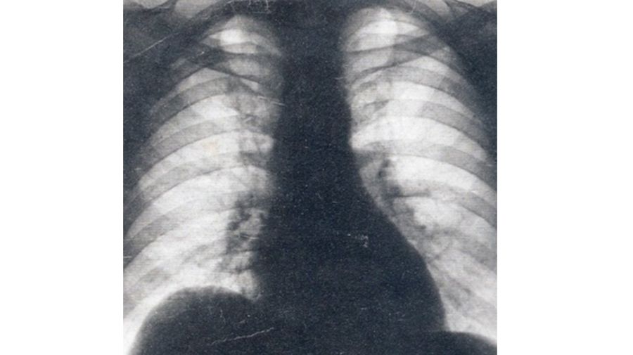 Radiografía de Perón