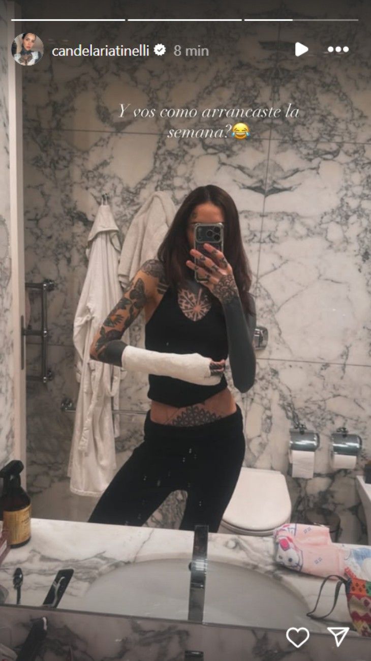 Cande Tinelli accidentada