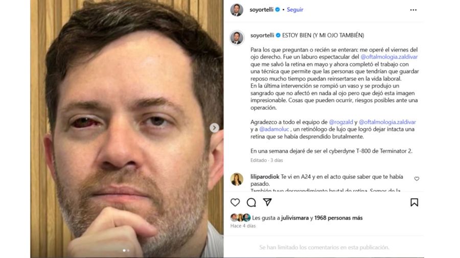Ignacio Ortelli sobre su salud