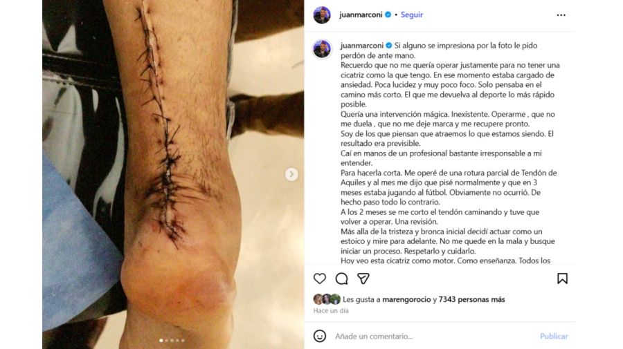 La operación de Juan Marconi