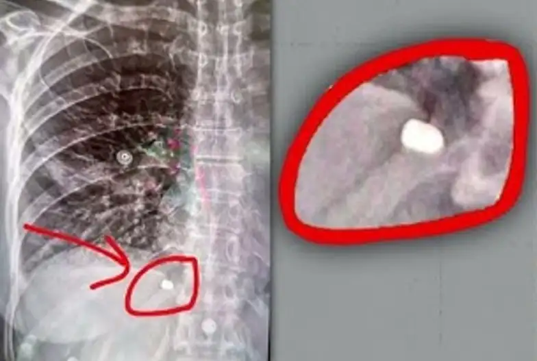 Una mujer fue baleada mientras paseaba en lancha en Escobar 20251106