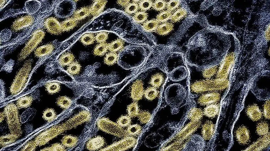 Gripe Aviar 02122025