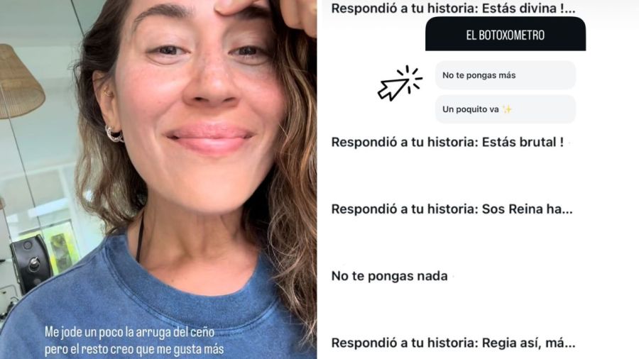 Jimena Barón celebró sus dos años libre de botox