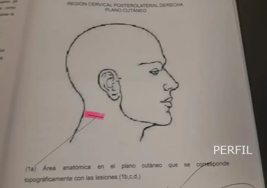 Caso Xiomara 20251218