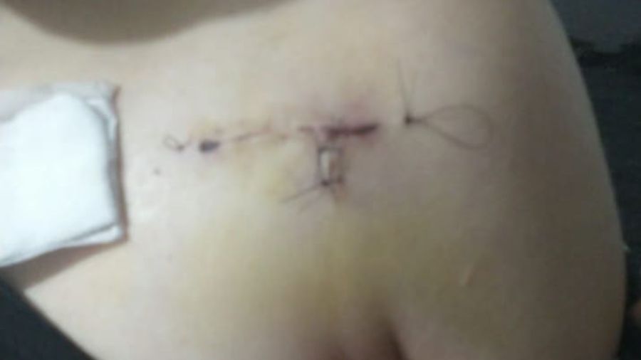 adolescente-apunalada-en-cordoba-2156537.jpg?webp