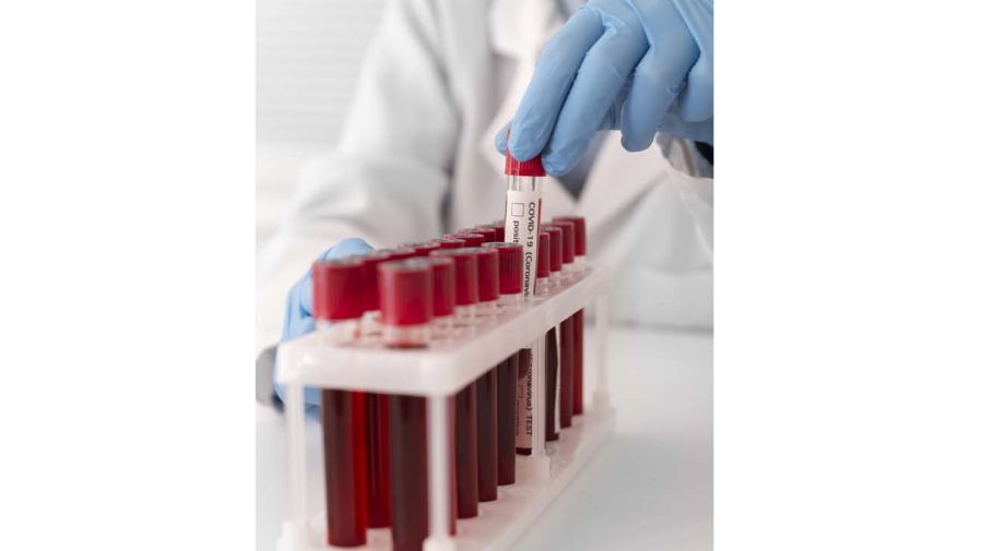 Sacar sangre en ayunas