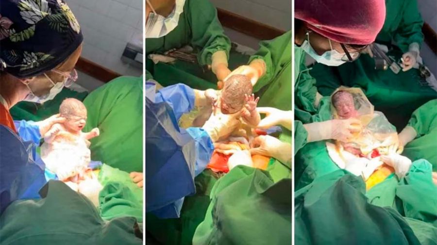 Nacieron Trigemelas en Chubut 28122025