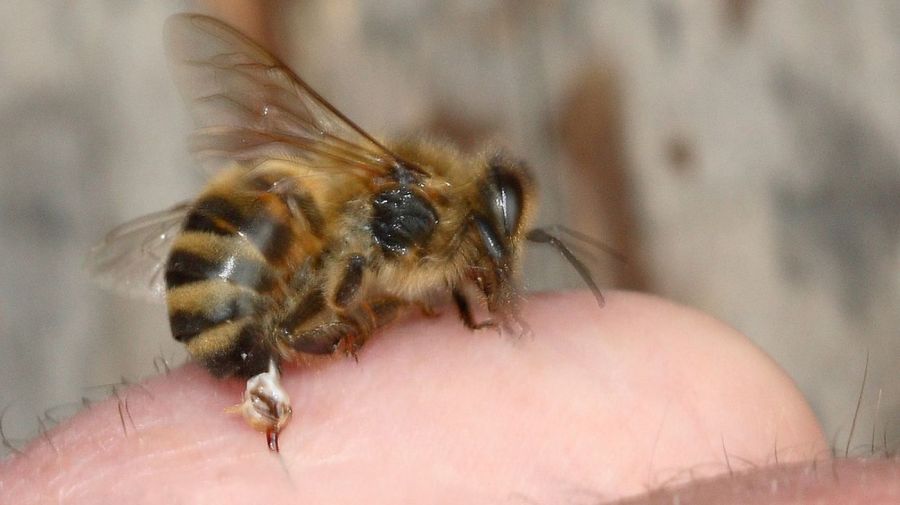 Picadura de abeja