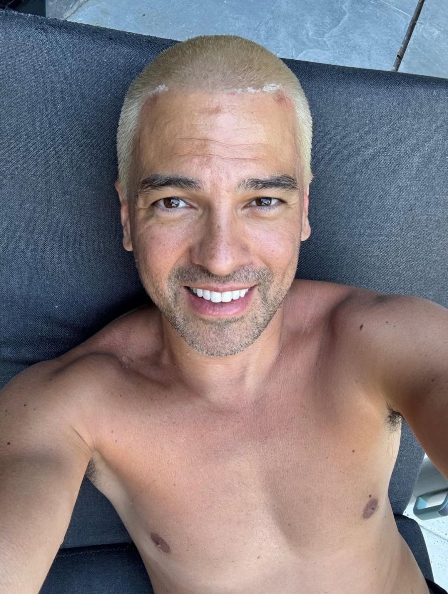 El cambio de look del Chino Leunis