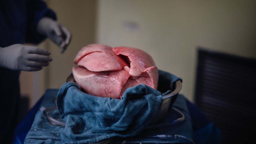 trasplante organos drones