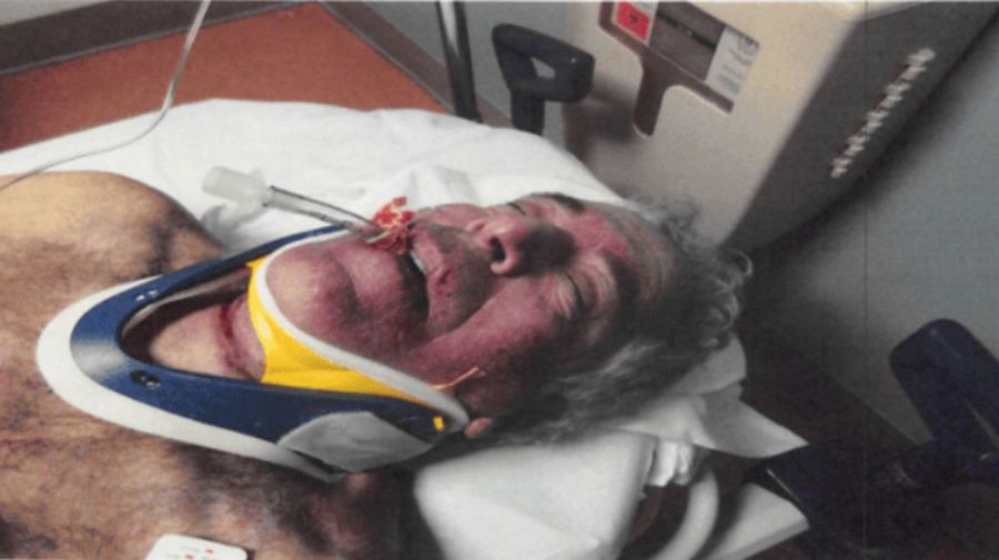 Las primeras fotos de Jeffrey Epstein muerto