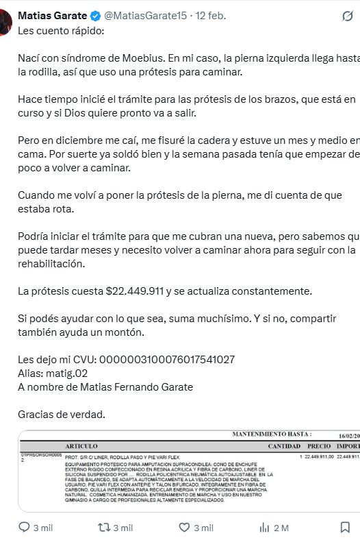 Matías Garate pidió ayuda para sus prótesis en redes sociales.