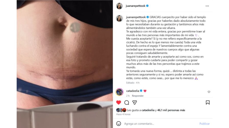 Juana Repetto reflexionó sobre su cuerpo