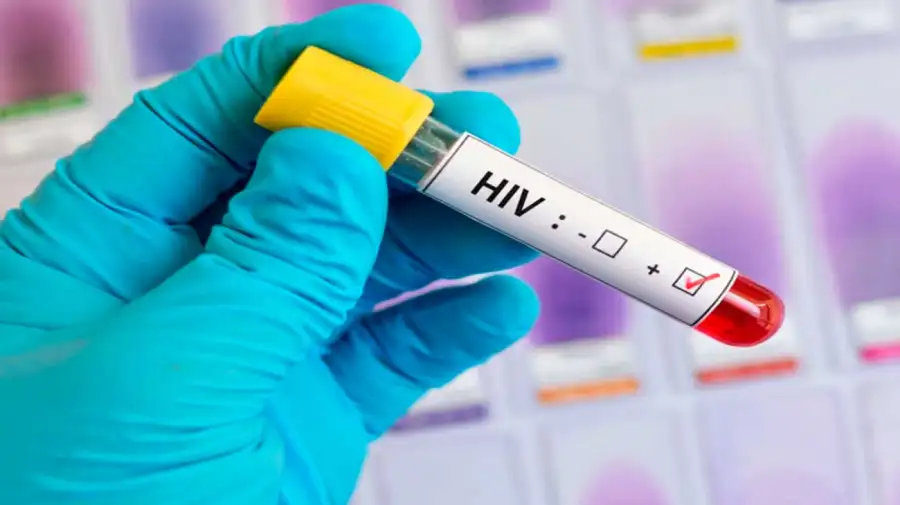 Remisión del VIH tras recibir un trasplante de células madre 13042026