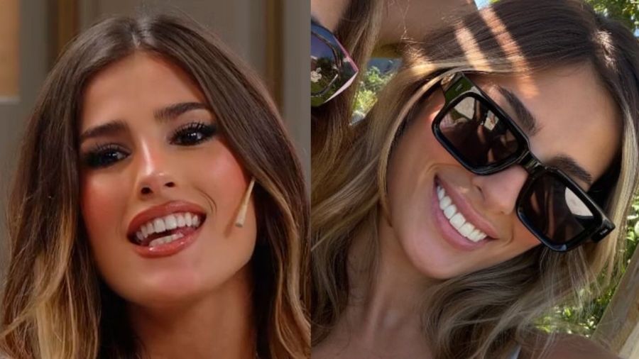 Juli Poggio, el antes y después de su sonrisa