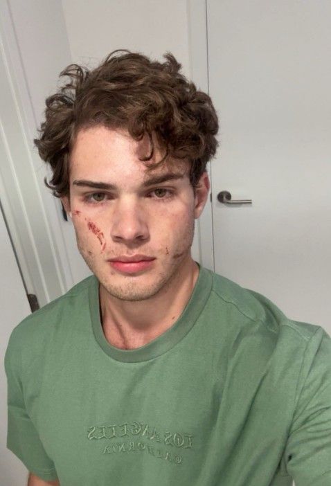 Braden Peters conocido como Clavicular