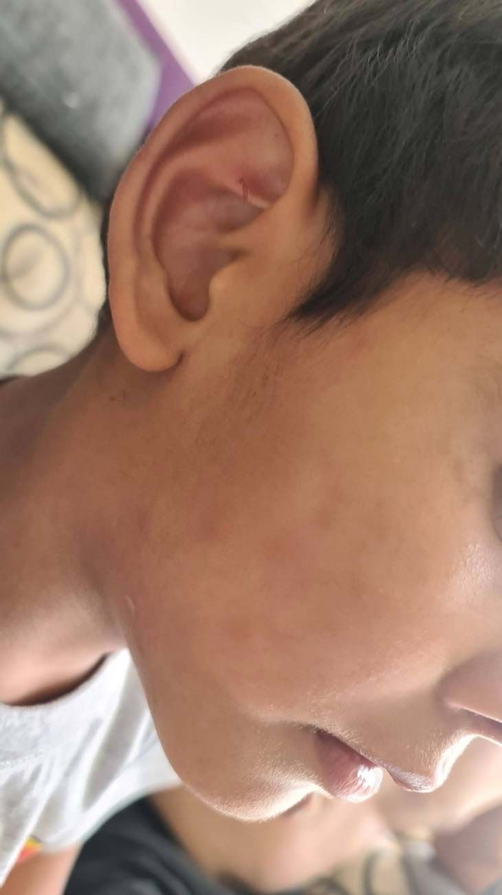 Caso Ángel Comodoro Rivadavia 15042026