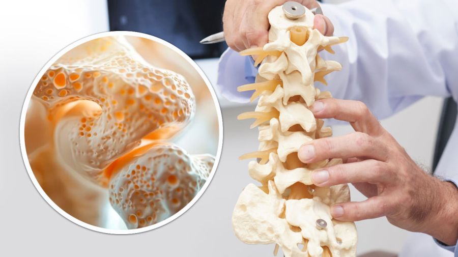 Artemis II: los astronautas pueden perder el 15% de masa ósea por mes 17042026