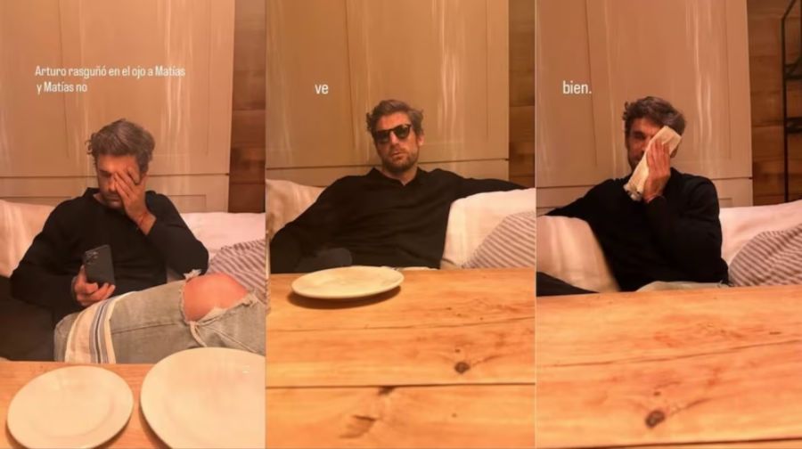 Jimena Barón sobre el accidente doméstico que sufrió su novio Matías Palleiro