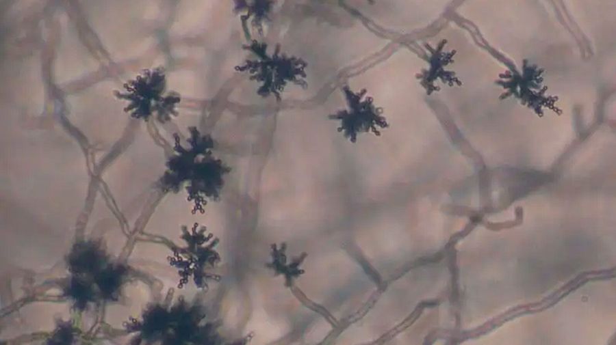 Ladosporium Sphaerospermum: Hongo negro de Chernobyl 24042026