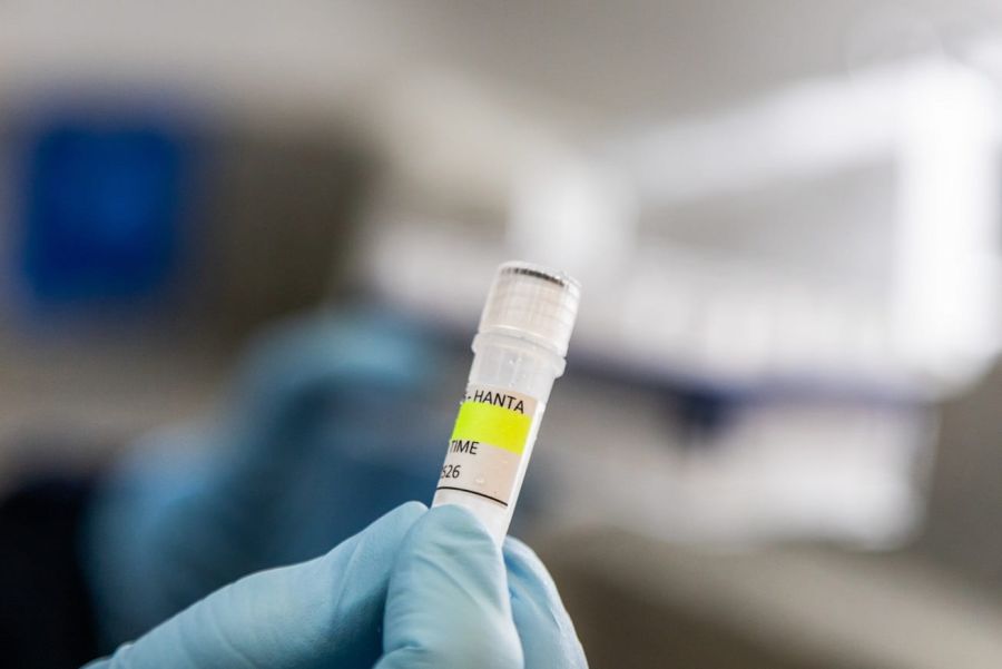 Hantavirus_investigación