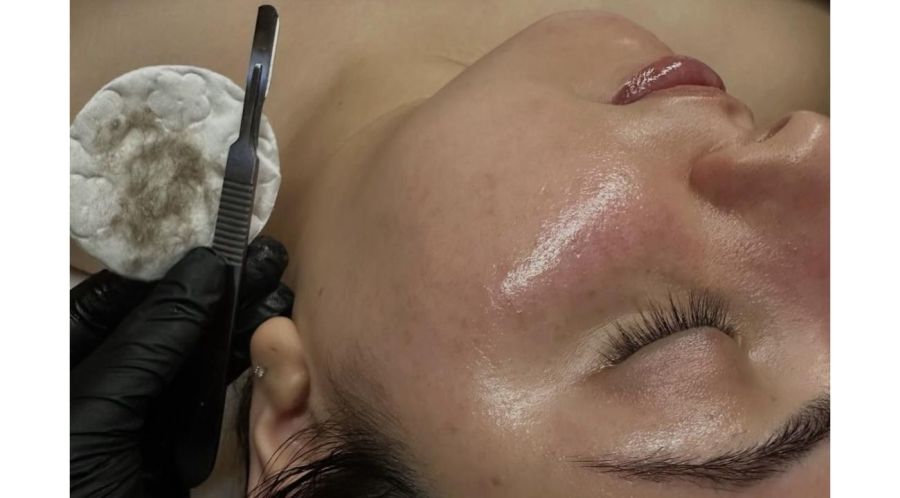 El nuevo lujo es una piel saludable: los tratamientos beauty más solicitados hoy