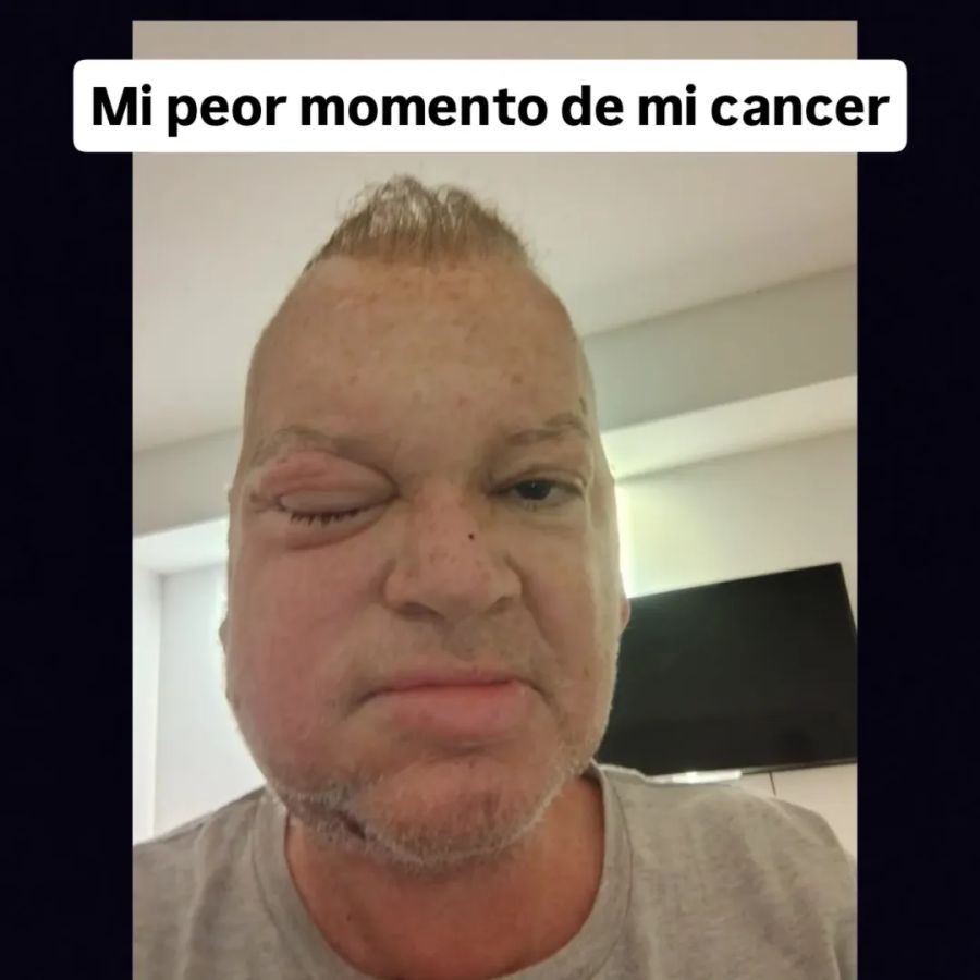 Leandro Rud sobre su lucha contra el cáncer