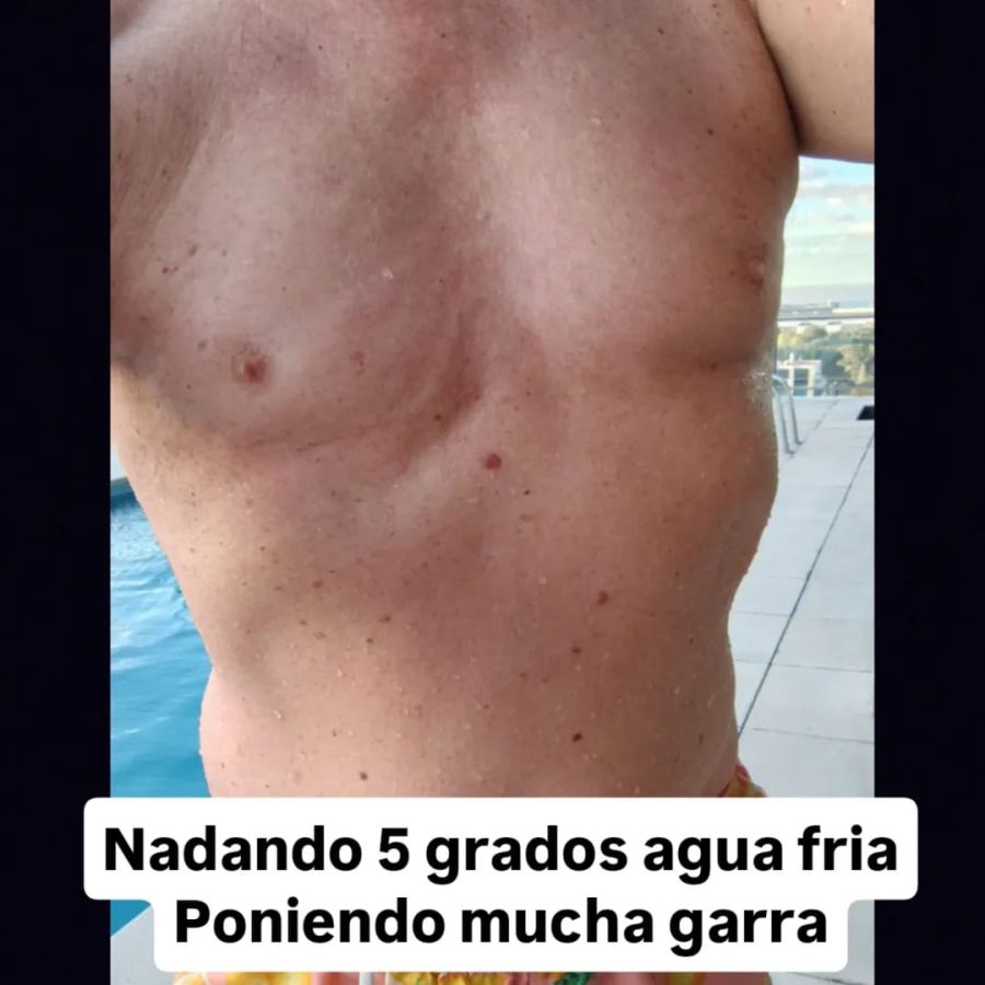 Leandro Rud sobre su lucha contra el cáncer