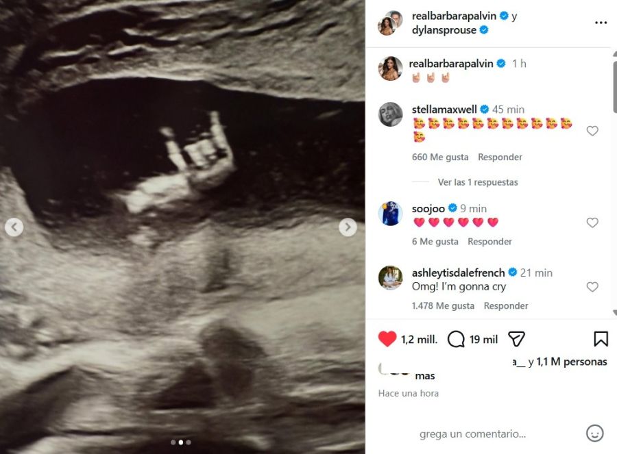 Barbara Palvin y Dylan Sprouse esperan su primer hijo juntos, la ecografia
