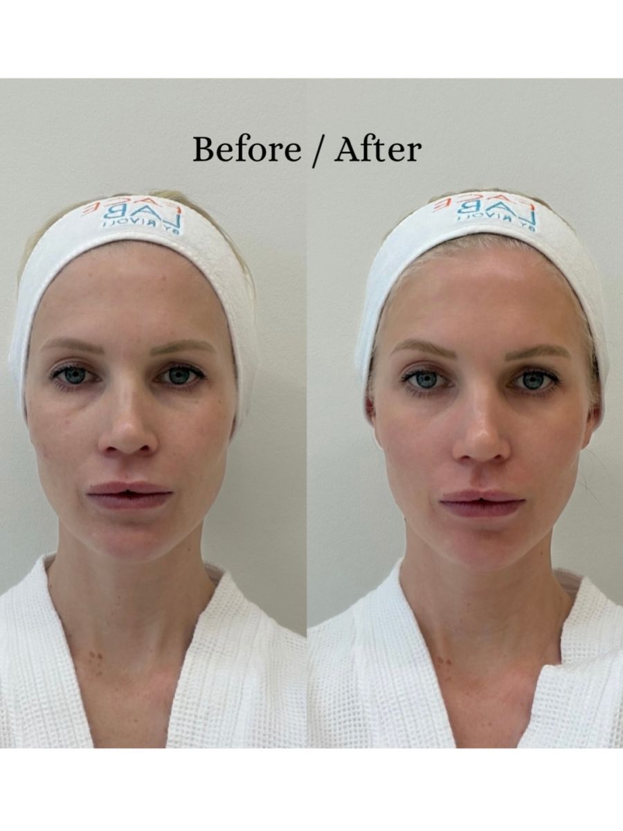 Daniela Christiansson en su tratamiento de détox facial