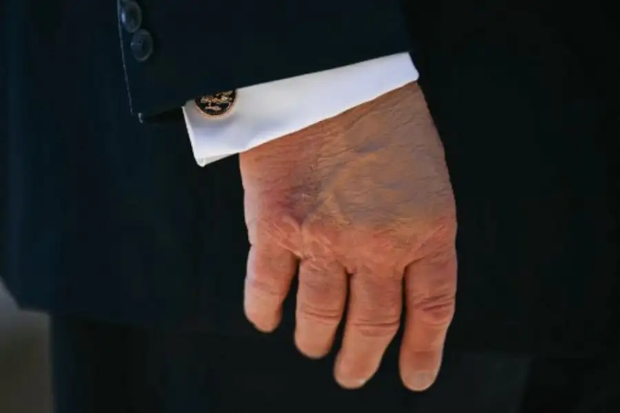 La salud de Donald Trump