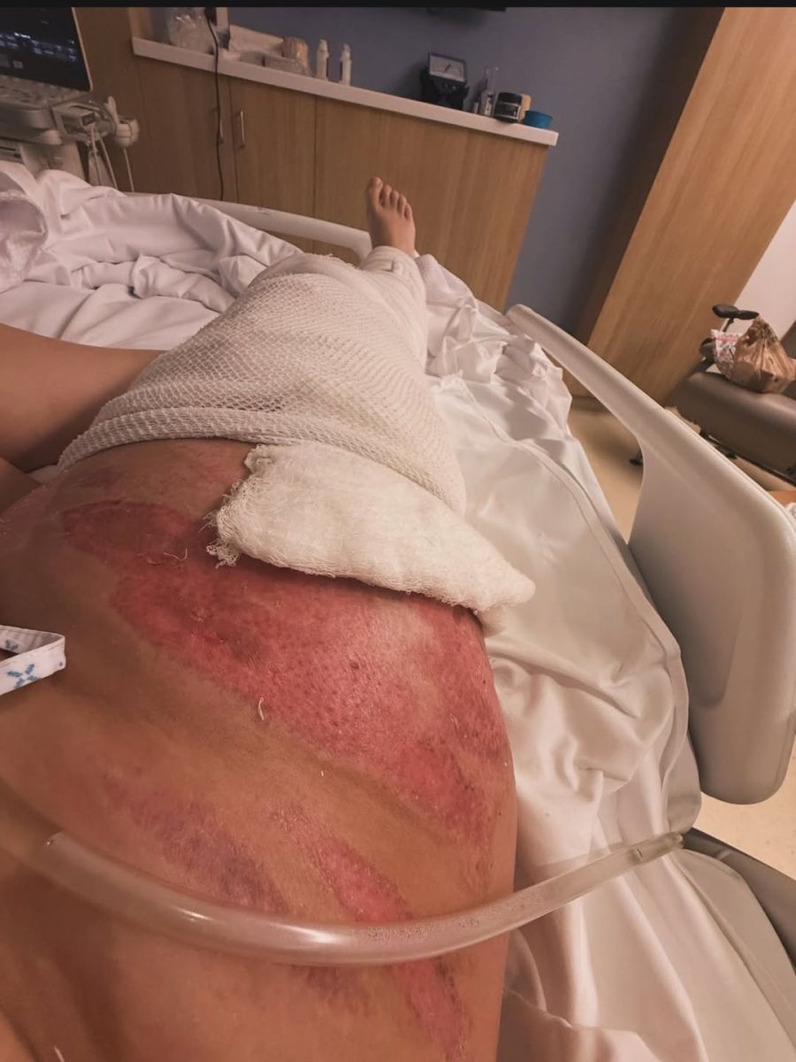 María Julia Oliván a un año de su accidente