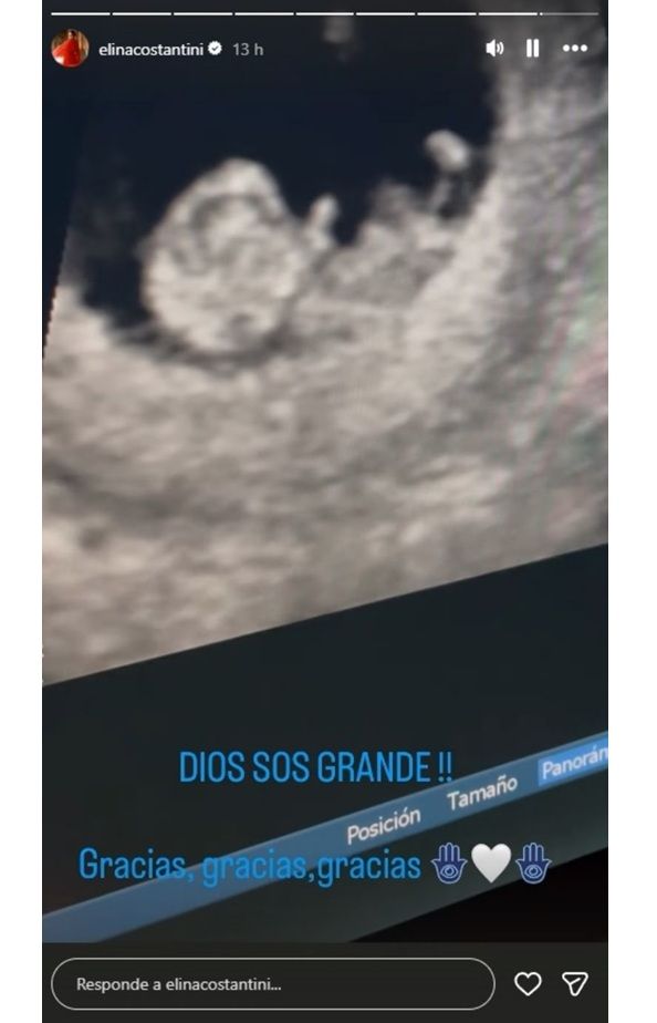 Elina Constantini confirmó su segundo embarazo