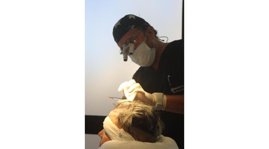 Dr. Gastón Forza: especialista en alopecia e implante capilar