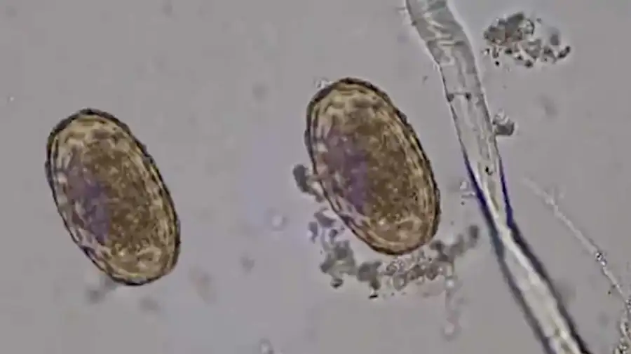 Ciclosporiasis 03082026