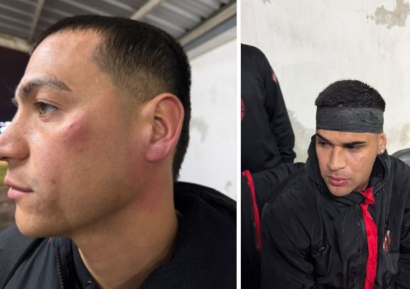 Agresión a los jugadores de Patronato
