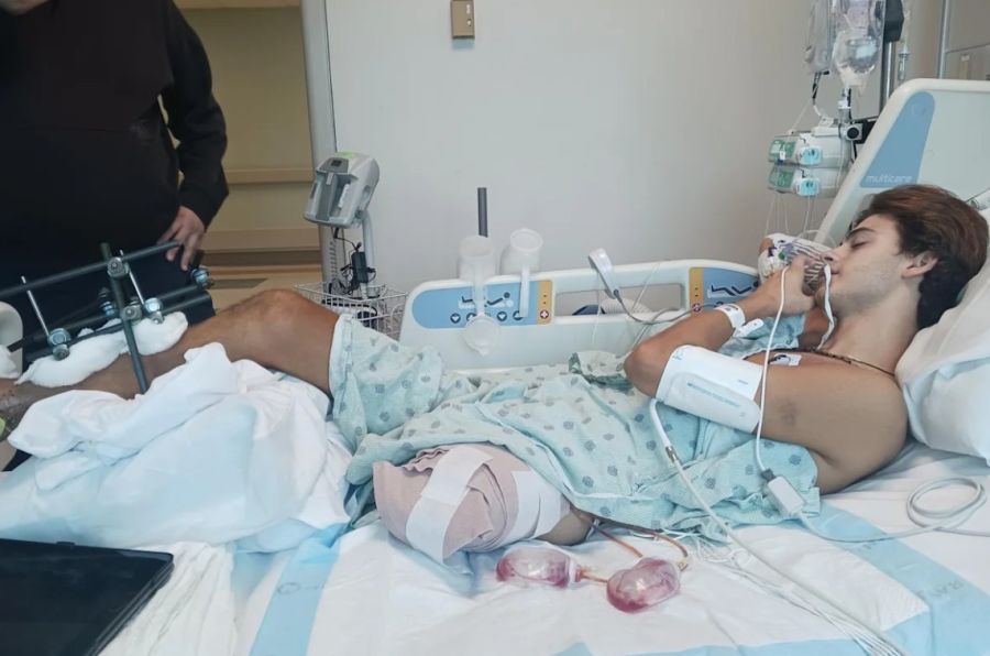 Stavros Floros, concursante de Survivor Grecia, tras su accidente