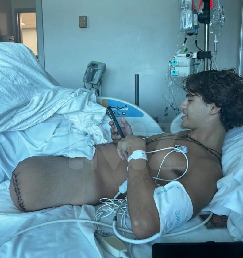 Stavros Floros, concursante de Survivor Grecia, tras su accidente 