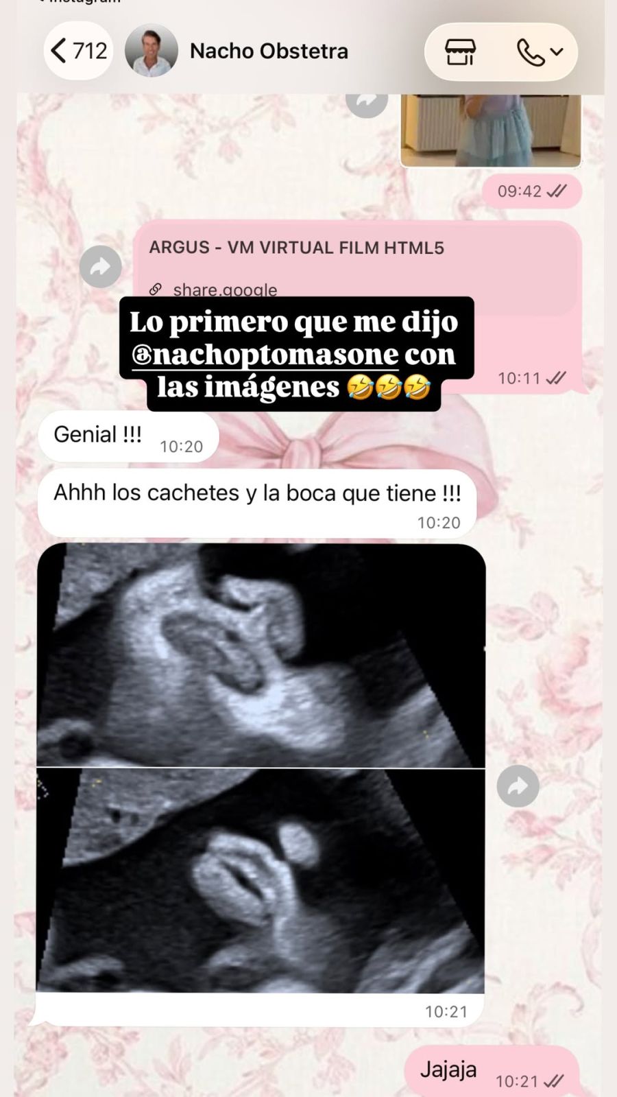 Stephanie Demner reveló detalles de su embarazo: cómo será Jazmín