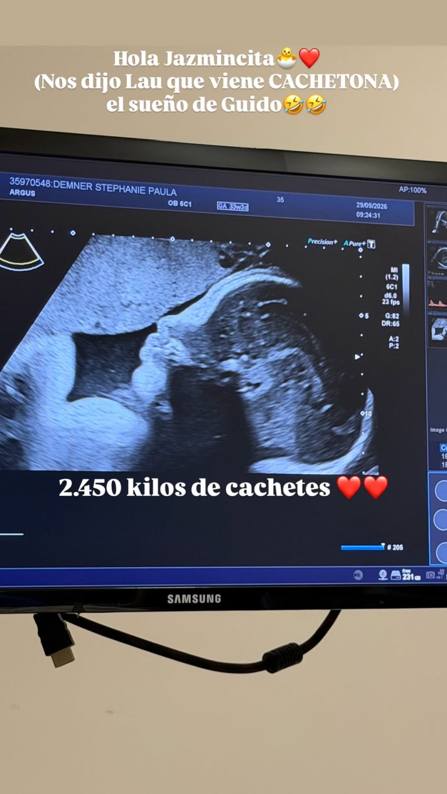 Stephanie Demner reveló detalles de su embarazo: cómo será Jazmín