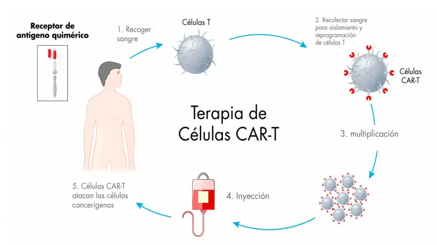 Terapia CAR T