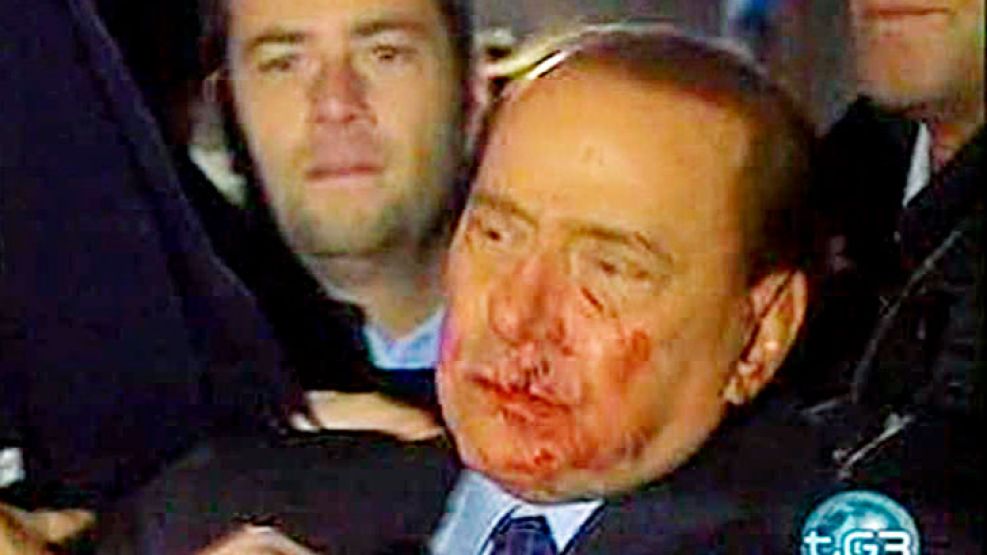 Berlusconi con el rostro ensangrentado
