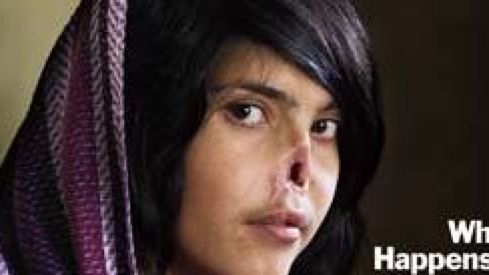 Aisha tiene 18 años y su marido talibán le cortó la nariz y las orejas