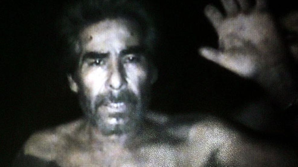 El minero Mario Gómez muestra las huellas del terrible momento que viven en la mina San Esteban.