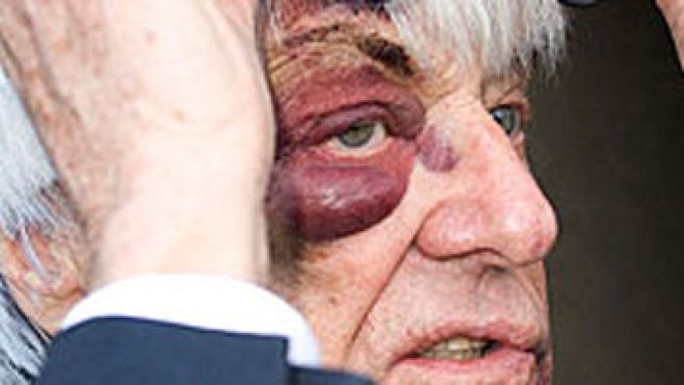 El rostro de Bernie Ecclestone tras declarar ante la policía.