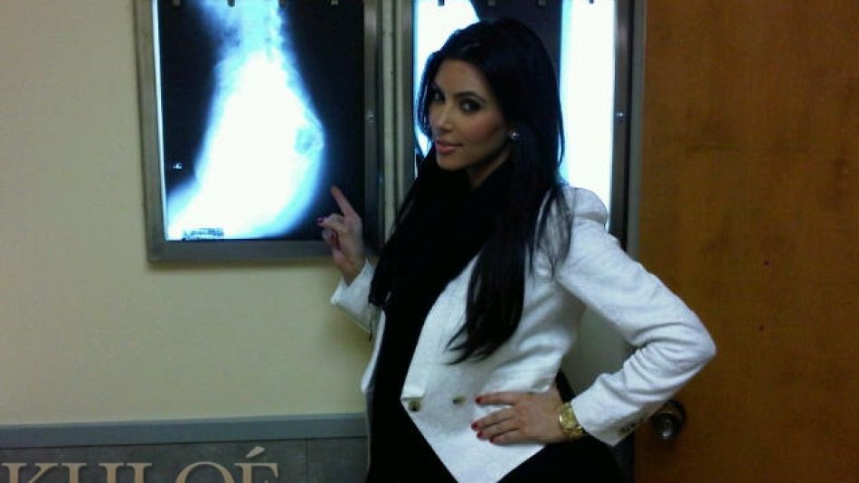 Radiografía del trasero de Kim Kardashian