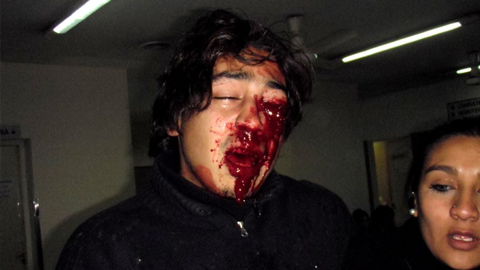 Gonzalo Aragón perdió un ojo tras la batalla campal.