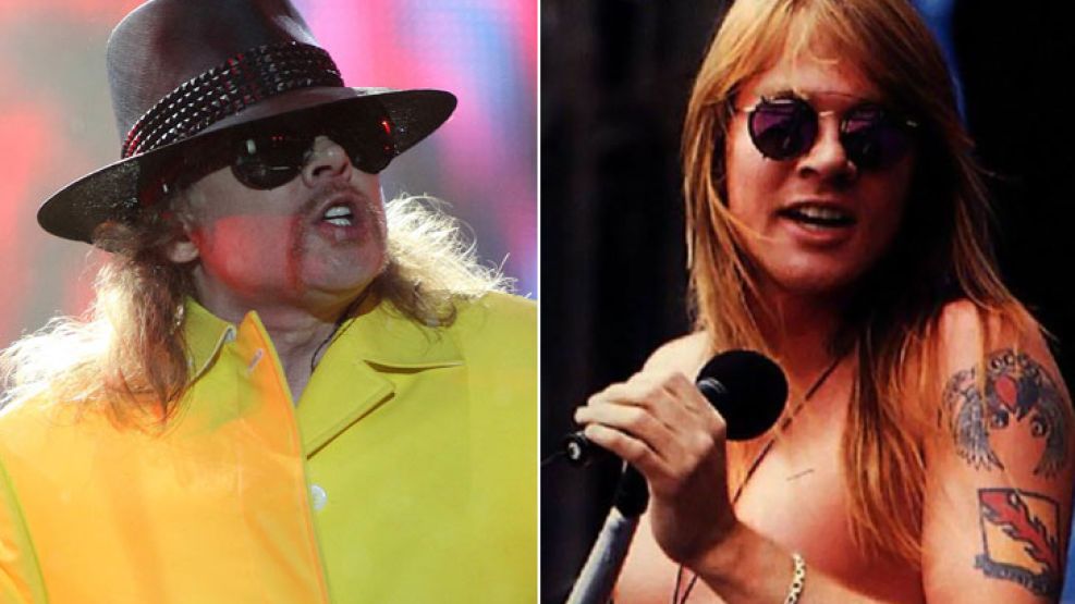 Axl Rose acumuló millones y kilos de más